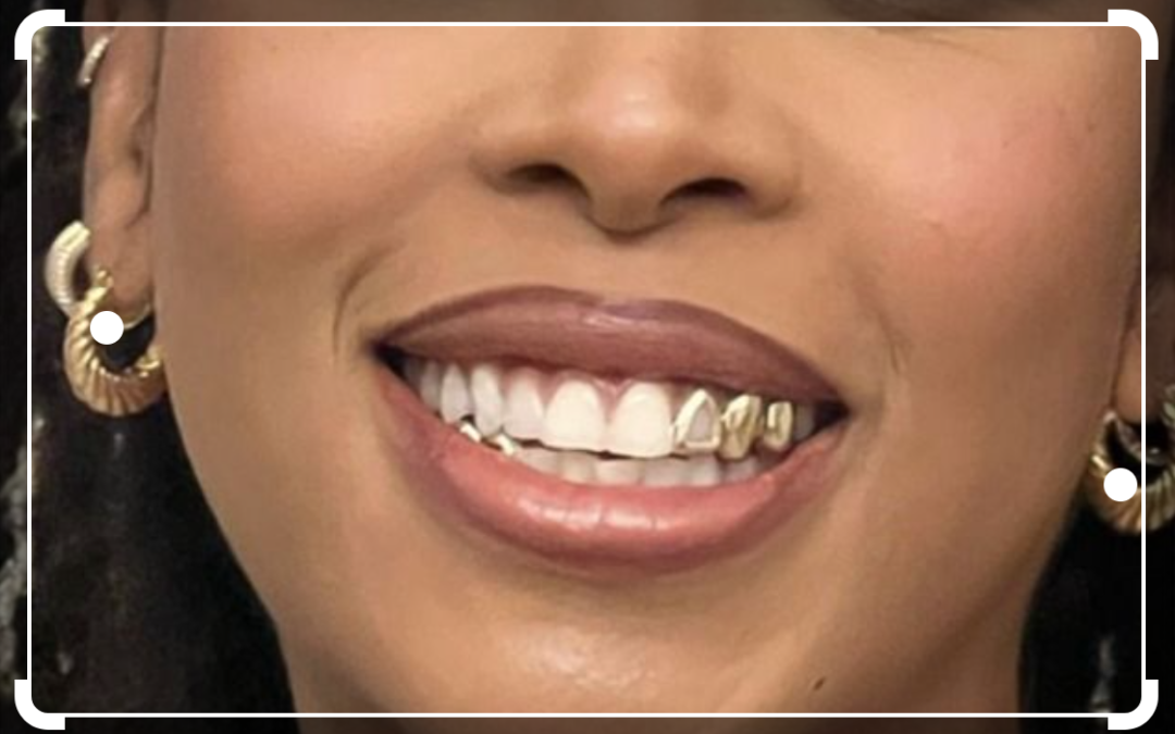 Gold Dental Implants: Are They As Good As Titanium?