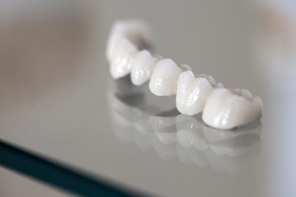 Dental Crowns: The Royal Treatment For a Tooth