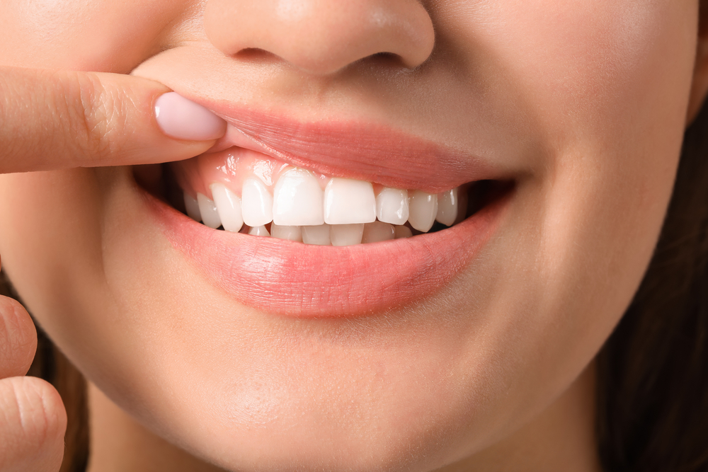 Preventing Gum Disease: Daily Habits That Protect Your Smile