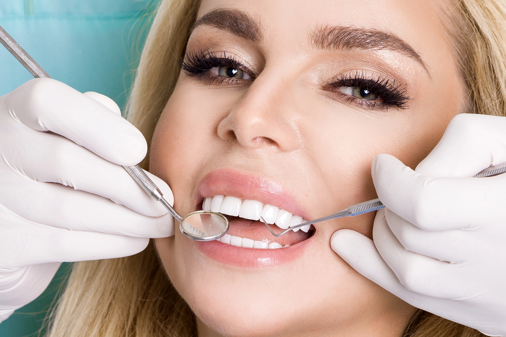 veneers