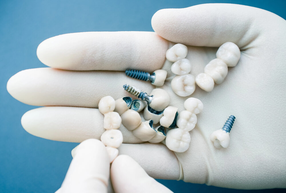 Why the Future of Dental Health in Australia Depends on Earlier Intervention and Smarter Dental Implant Care