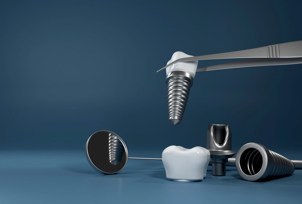The Fashion Industry’s Quiet Influence on Australia’s Growing Interest in Dental Implants